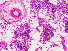 Набор микропрепаратов Bresser «Гистология», 30 шт., в кейсе